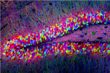 Гиппокамп мыши, поперечный срез с флуоресцентно окрашенными клетками