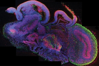 Срез органоида, покрашенный маркерами различных нейронов