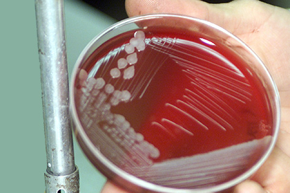 Бактерии сибирской язвы 