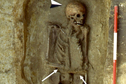 В старинной могиле нашли первого в мире киборга