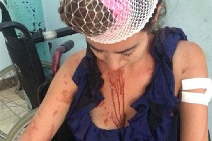 Уборщица побила британскую туристку металлической палкой за отказ платить
