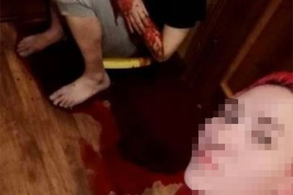 Жена сделала селфи на фоне истекающего кровью мужа