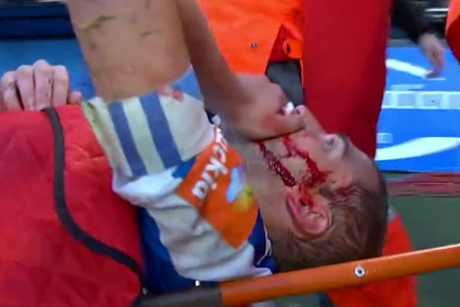 Футболист ударом ноги разбил сопернику лицо