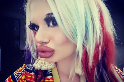 Болгарская студентка увеличила губы в три раза из-за местной моды