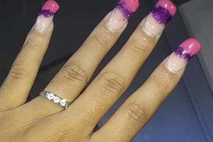 Женщина похвасталась обручальным кольцом и была пристыжена за «уродливые» ногти