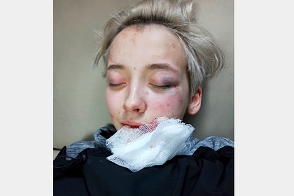 В России семеро парней избили 18-летнюю девушку из-за ориентации