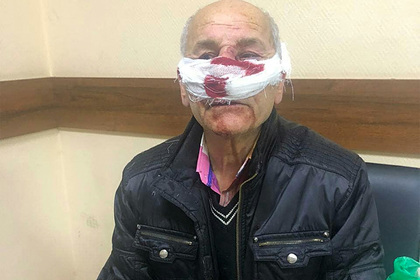 Врач скорой избил россиянина по дороге в больницу