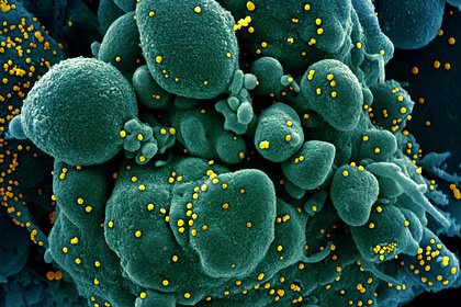 У людей с ВИЧ обнаружили преимущество во время пандемии коронавируса