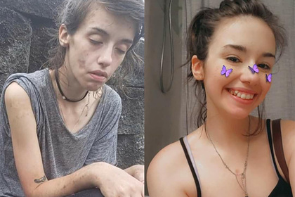 Девушка бросила наркотики и удивила людей преображением до неузнаваемости