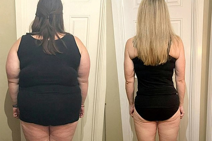 Женщина сбросила 76 килограммов и раскрыла действенный способ похудения