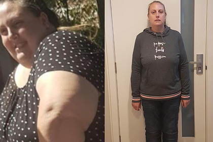 Тучная женщина сбросила 98 килограммов и описала проверенный способ похудеть