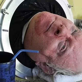 Мужчина 72 года прожил в железной капсуле из-за опасной болезни