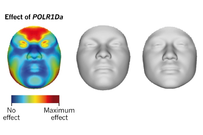 Зоны, находящиеся под влиянием полиморфизма POLR1Da, и трехмерная модель лица в разных экстремумах этого влияния.
