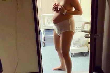 Обнаженное тело только что родившей матери в подгузниках осчастливило соцсети