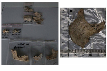 Во Франции раскопали коллекцию отрубленных голов