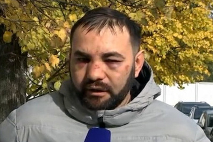 Побитый Мамаевым водитель потратил на лечение сотни тысяч рублей