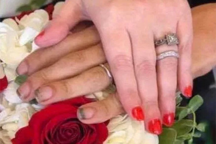 Руки жениха сразу после вступления в брак ужаснули пользователей сети