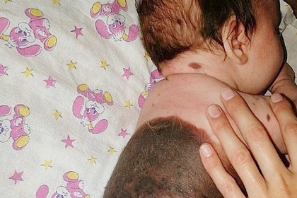 Российский батюшка испугался крестить малыша с родимым пятном из-за «заразности»