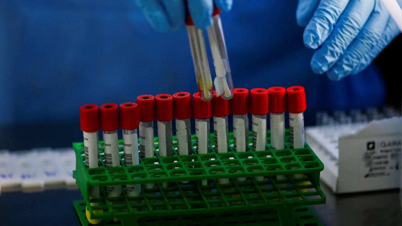 Качество выполнения тестов на омикрон в лабораториях в России вызвало сомнение